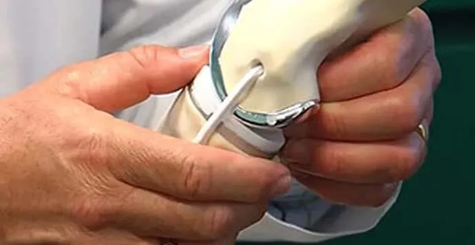 3D Yazıcılar ile Cerrahi Hazırlıklar