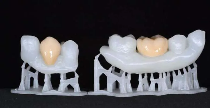 3D Yazıcılar ile Diş Uygulamaları