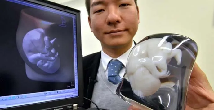 3D Yazıcılar ile Tıbbın Geleceği