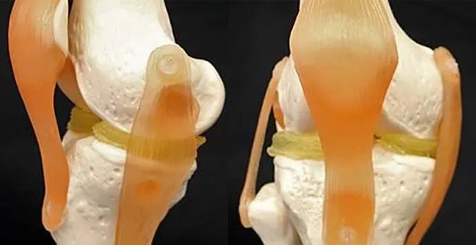 Kıkırdak Jel 3D Yazıcı