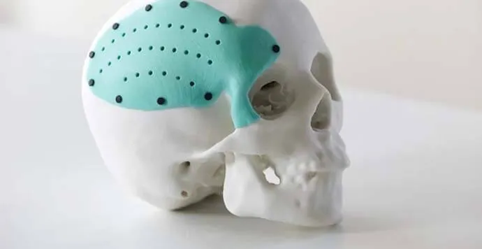 Medikal 3D Baskı ve Sağlık Uygulamaları