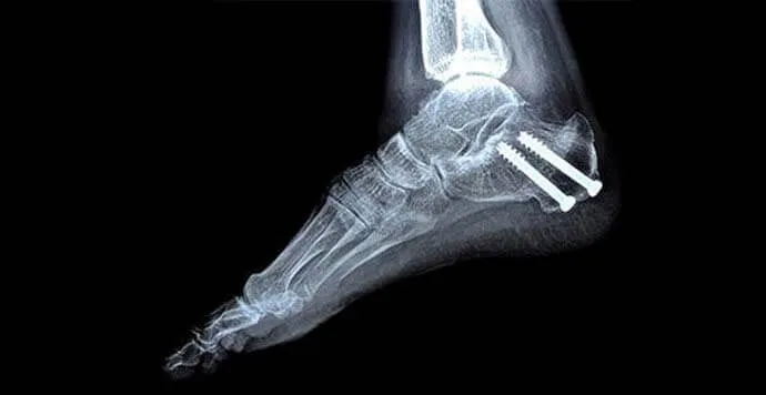 PLA Filament Toksik Değildir